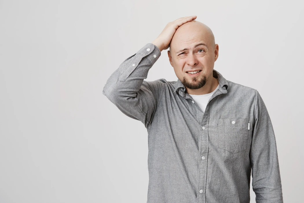 Hair Loss Image